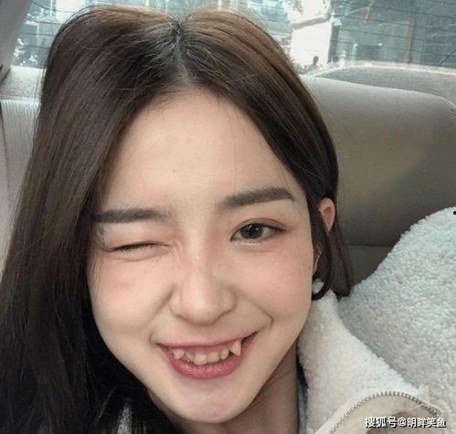 虎牙吃瓜事件结果